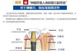 德国icx种植系统