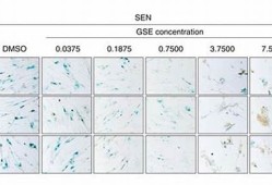 GALA汇率换算最新消息-GALA汇率换算今日行情-GALA汇率换算最新价格(gala币能涨到1美元吗)