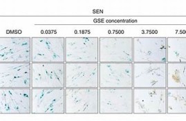 GALA汇率换算最新消息-GALA汇率换算今日行情-GALA汇率换算最新价格(gala币能涨到1美元吗)